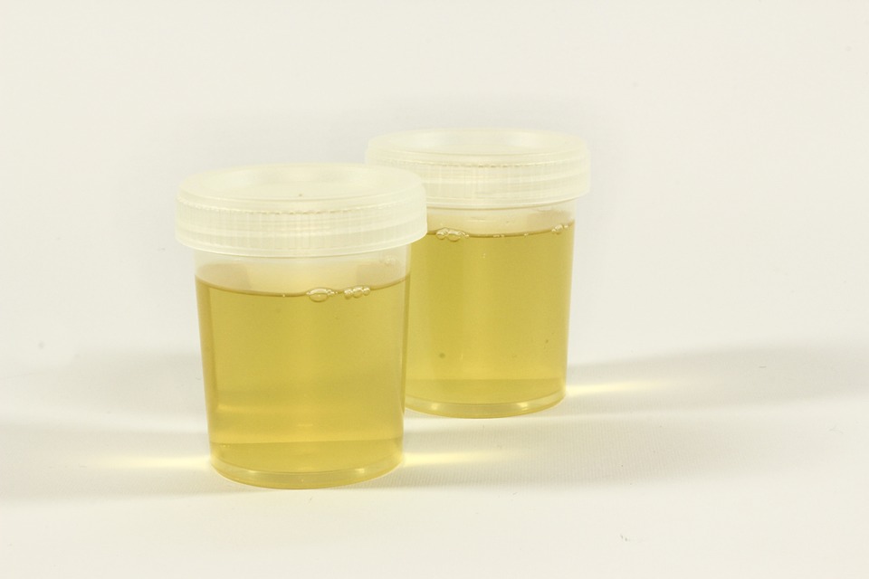 How to Choose the Best Synthetic Urine